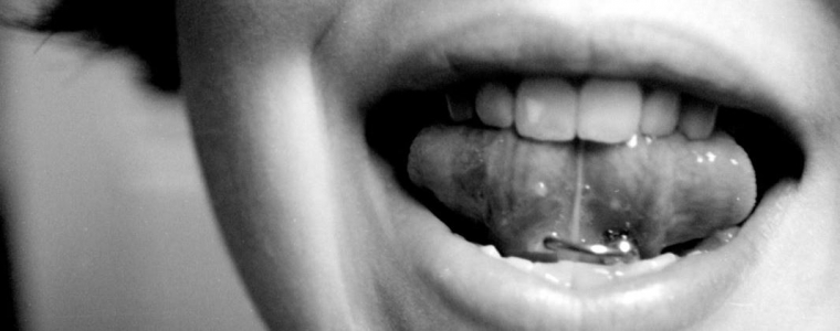 Jezične vratolomije