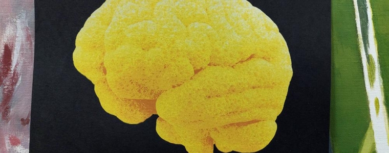 Obezglavljenost uz KLFM