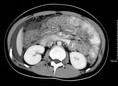Germansko nadriliječništvo