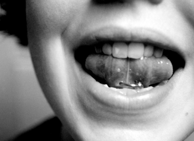 Jezične vratolomije