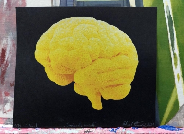 Obezglavljenost uz KLFM